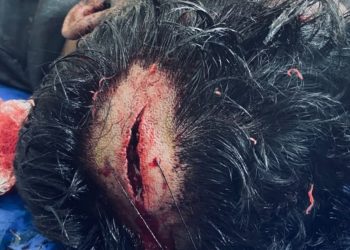 বাহুবলে টমটম-সিএনজি চালকদের বিরোধে একজন রক্তাক্ত, এলাকায় উত্তেজনা